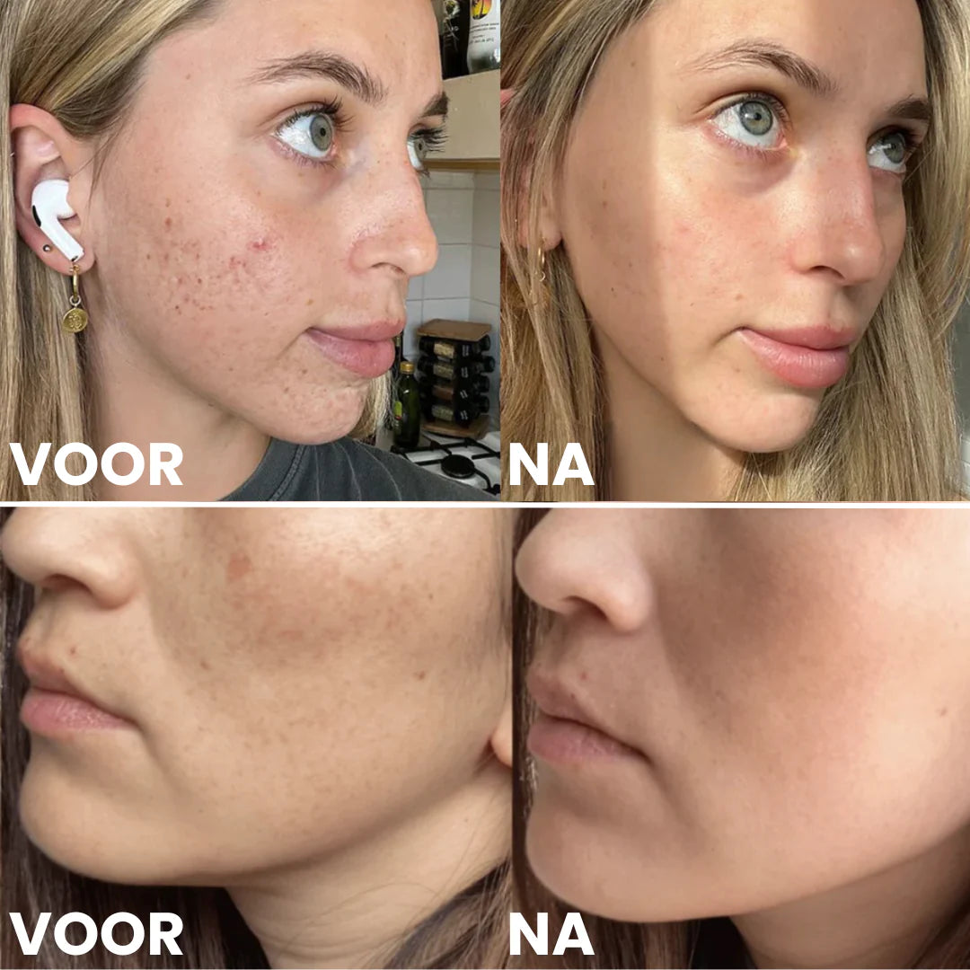 Kollagen-Gesichtsmasken | VOLUMENVORTEIL